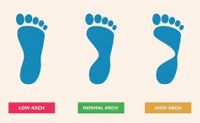 Do You Have High Arches, Flat Feet or Something In Between? - CMM - Your Foot Doctor