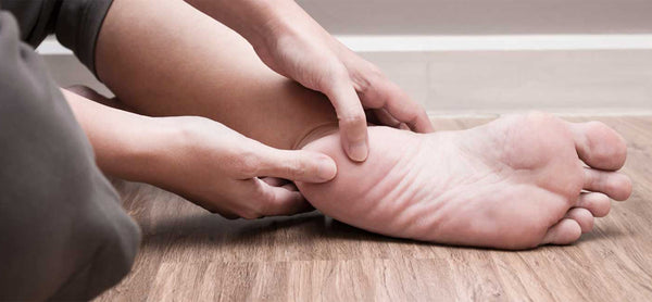 Plantar Fasciitis - Causes & Treatments to Prevent Plantar Fasciitis by CMM